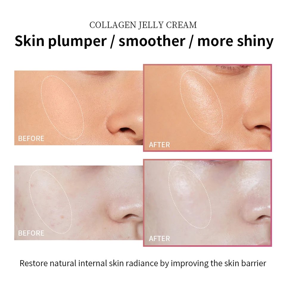 Anti Aging Collagen Face Cream 100ml Niacinamide Moisturizer Hydrating Gel For Tightening Soothing Firmness Skincare Anti Aging Collagen Face Cream 100ml Niacinamide Moisturizer Hydrating Gel For Tightening Soothing Firmness Skincare