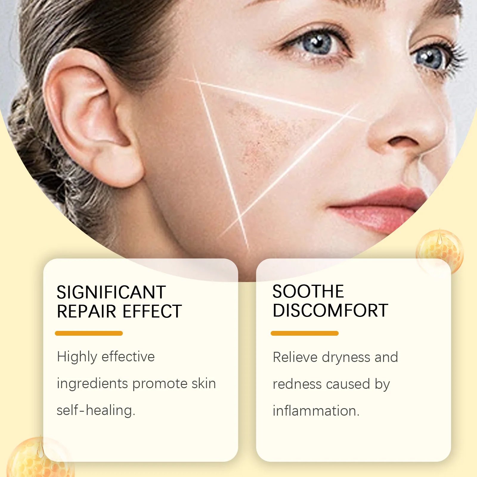 Bee Venom Skin Restoration Cream Skin Blemish Remover Reduce Redness Sensitive Skin Barrier Repair Skin Renewal Moisturizer 60g