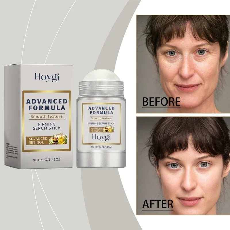 Retinol Hyaluronic Acid Stick Anti Wrinkle Tighten Pores Firming Lifting Plump Skin 24H Moisturizing Anti Aging Korean Care Balm Retinol Hyaluronic Acid Stick Anti Wrinkle Tighten Pores Firming Lifting Plump Skin 24H Moisturizing Anti Aging Korean Care Balm