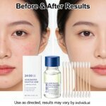 Salicylic Acid Drying Lotion Face Serum with Cotton Swab– Reduce Pimples & Breakouts Fade Acne Scars Minimize Pores Skin Renewal - Image 2