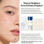 Salicylic Acid Drying Lotion Face Serum with Cotton Swab– Reduce Pimples & Breakouts Fade Acne Scars Minimize Pores Skin Renewal - Image 3